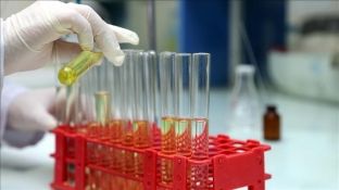 Vaksina e re kundër HIV-it, “gozhda e fundi në arkivolin” e kësaj sëmundje