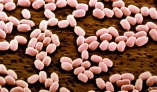 Përhapet epidemia e Antraksit në Rusi