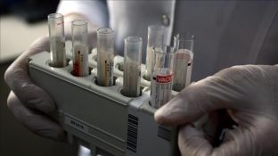 Viruset 10 herë më të rrezikshëm nëse infektojnë në mëngjes