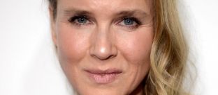  Renee Zellweger shpërthen ndaj medieve për spekulimet për ndërhyrje kirurgjike
