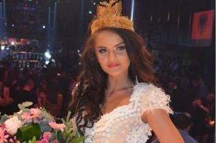 Njihuni me “shqiptaren më të bukur në botë” [foto]