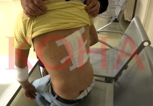 Sulmohet një i ri nga qentë endacakë në lagjen Mati 1 në Prishtinë [video]