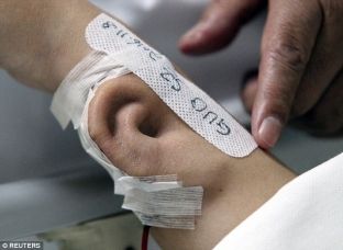 Doktori ia rrit veshin e ri në dorë, pacienti pret kthimin e dëgjimit