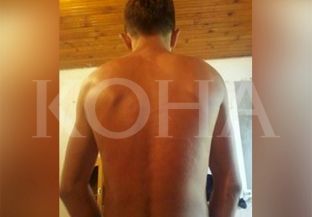  Nxënësi akuzon arsimtarin në Rahovec se e rrahu brutalisht [video]